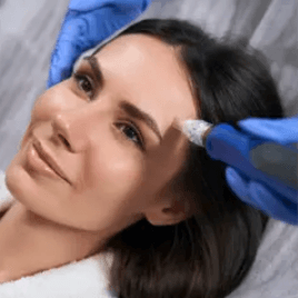 SkinPen at Brandy's Beauty Bar SRQ in Sarasota, FL