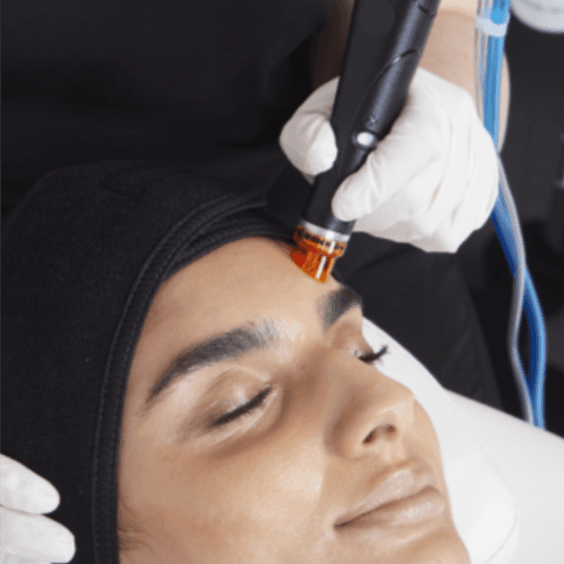 The Recharge HYDRAFACIAL at Brandy's Beauty Bar SRQ in Sarasota, FL